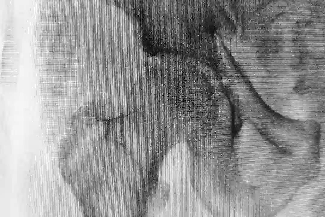 Black and white picture of the pelvic area